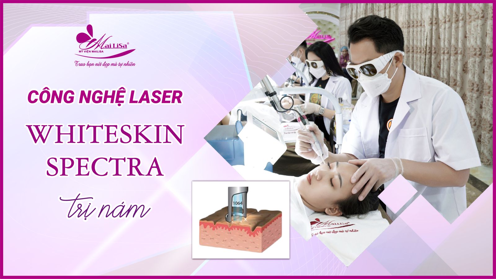 Bắn laser trị nám Whiteskin spectra có tốt không? Chi phí 2023 Bắn laser trị nám Whiteskin spectra có tốt không? Chi phí 2023