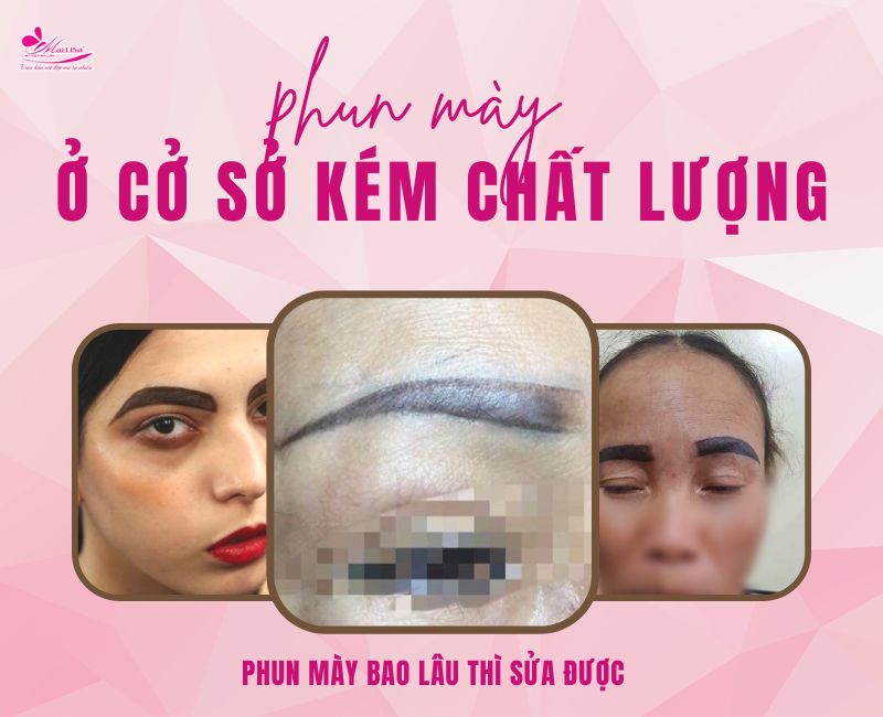 Xăm lông mày bị hỏng phải làm sao? Cách chỉnh sửa lông mày bị lỗi 2022 xăm chân mày bị lỗi