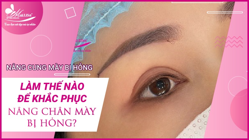 Biến chứng nghiêm trọng nâng cung mày bị hỏng 2023 Có mẹ nào nâng cung mày chưa