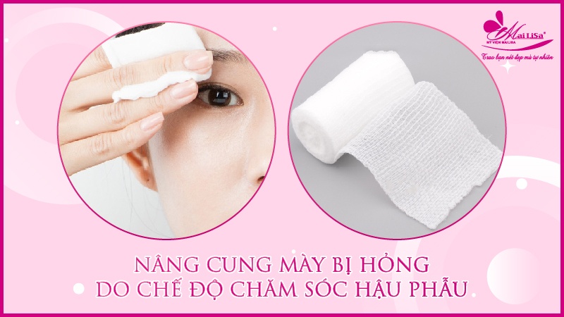 Biến chứng nghiêm trọng nâng cung mày bị hỏng 2023 Review nâng cung mày