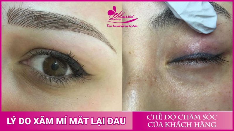 Phun mí mắt có đau không? Những lưu ý cần biết khi phun mí mắt xăm mí mắt đẹp