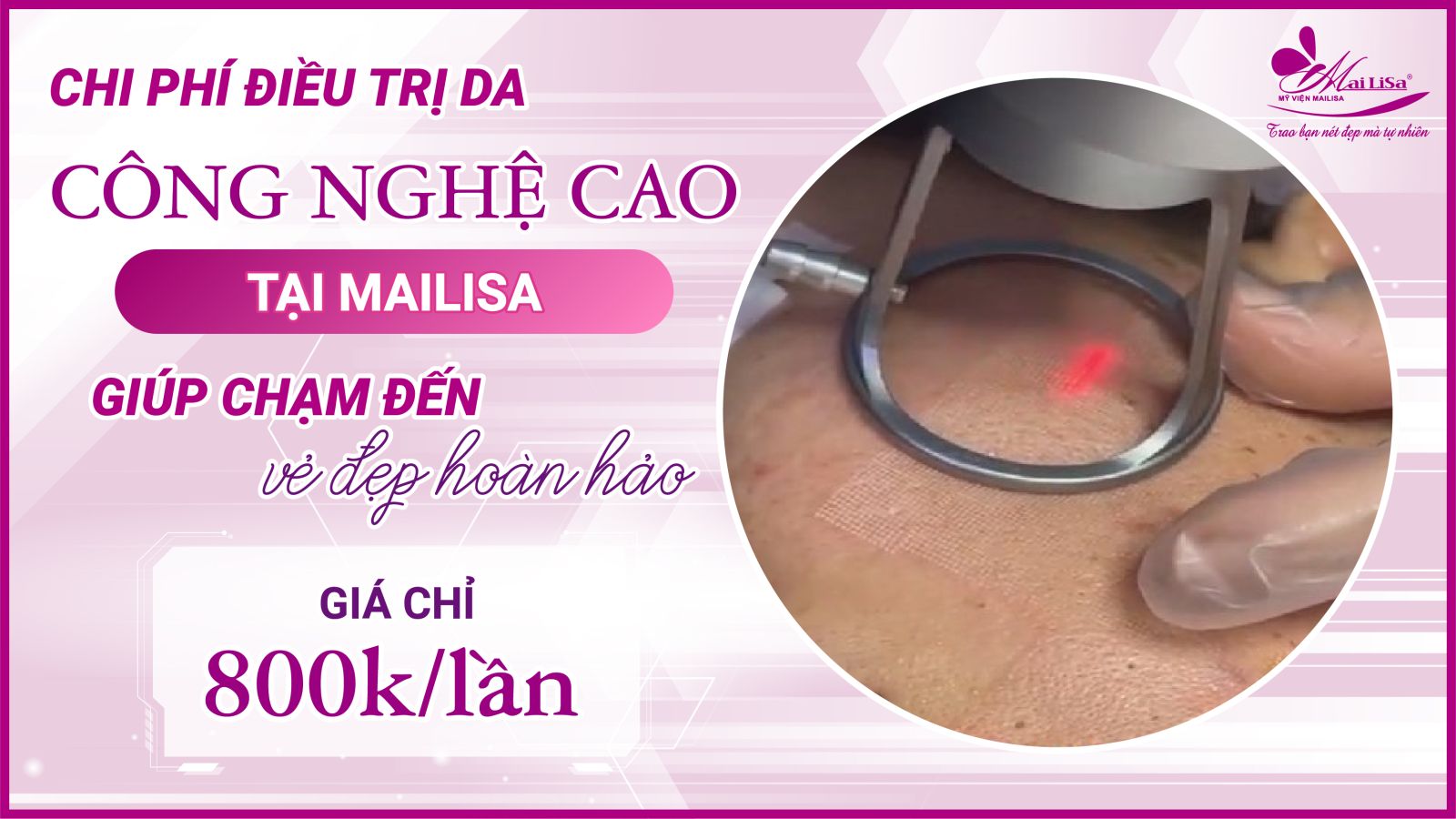 Bắn laser trị nám Whiteskin spectra có tốt không? Chi phí 2023 Chi phí điều trị da tại Mailisa