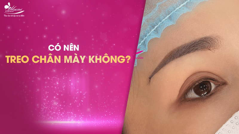 Treo chân mày là gì và có những phương pháp nào năm 2024 8 - 8 treo chân mày co nen treo cung chan may
