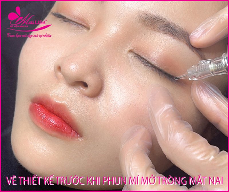 Phun mí mở tròng mắt nai giúp đôi mắt có hồn đẹp tự nhiên 2022 phun mí mở tròng hàn quốc