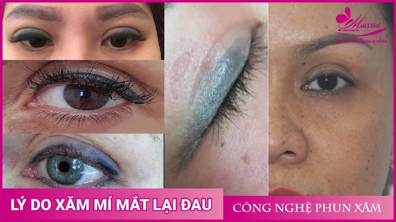 Phun mí mắt có đau không? Những lưu ý cần biết khi phun mí mắt phun mí mắt đẹp