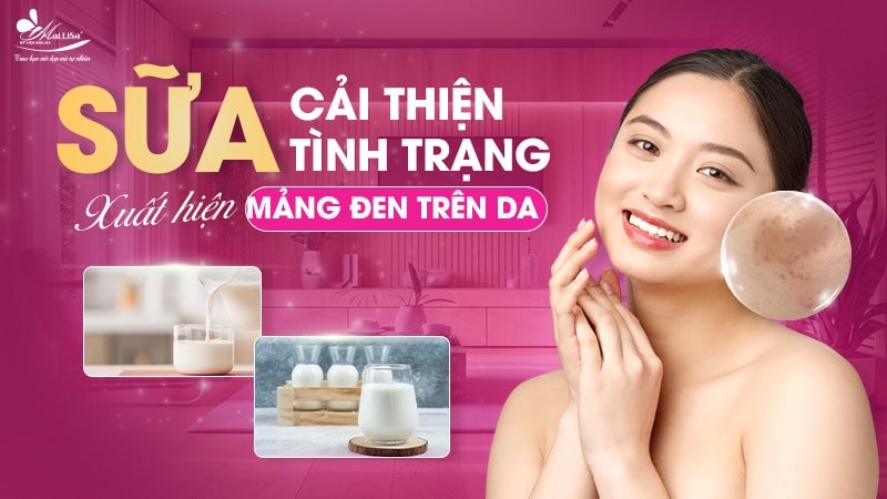 8 Cách trị đốm nâu trên mặt thịnh hành hiện nay 15 - 15 đốm nâu trên mặt da noi dom den