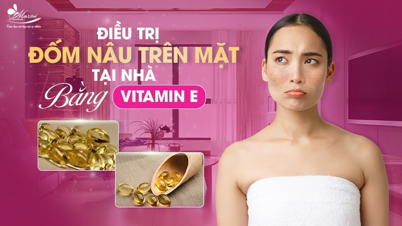 8 Cách trị đốm nâu trên mặt thịnh hành hiện nay 10 - 10 đốm nâu trên mặt da noi dom nau