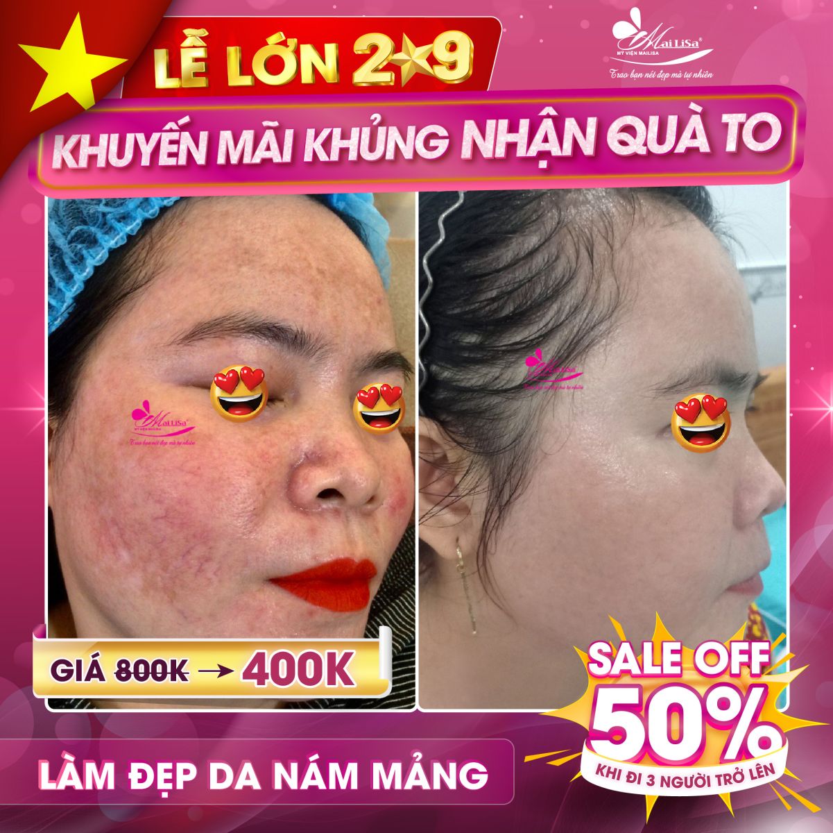 LỄ LỚN - KHUYẾN MÃI KHỦNG - NHẬN QUÀ TO LỄ LỚN - KHUYẾN MÃI KHỦNG - NHẬN QUÀ TO