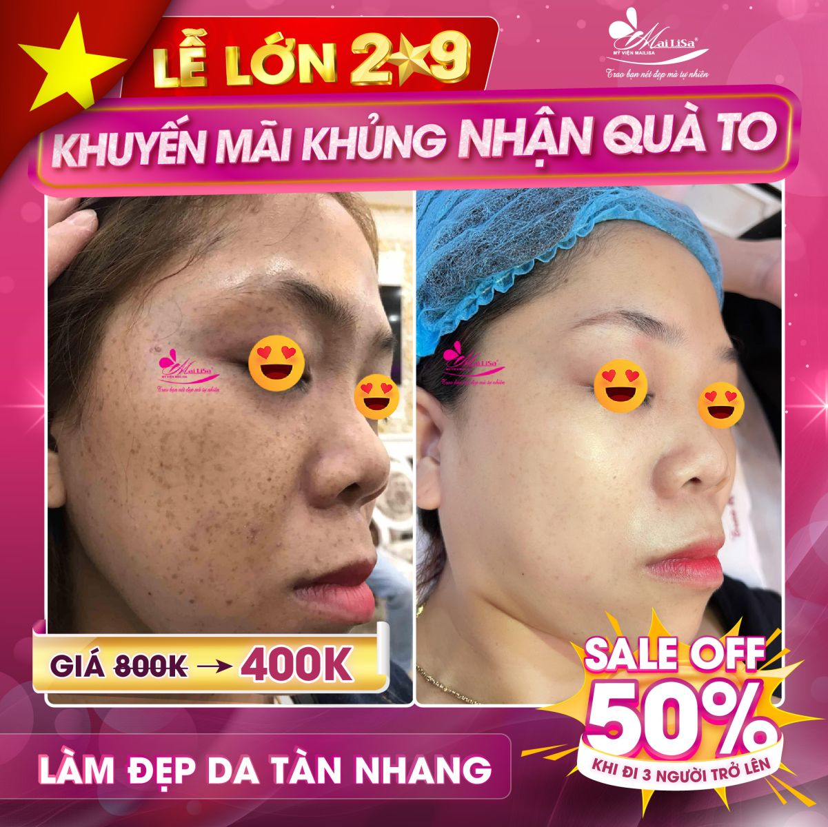 Mailisa LỄ LỚN - KHUYẾN MÃI KHỦNG - NHẬN QUÀ TO