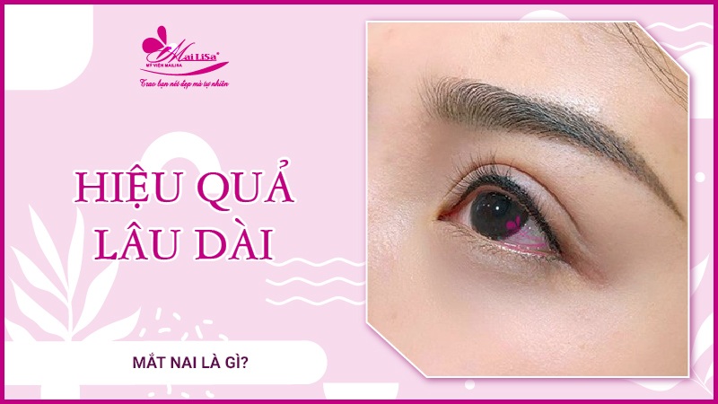 Mắt nai là gì? Tướng số người mắt nai sẽ như thế nào Đạt hiểu quả lâu dài