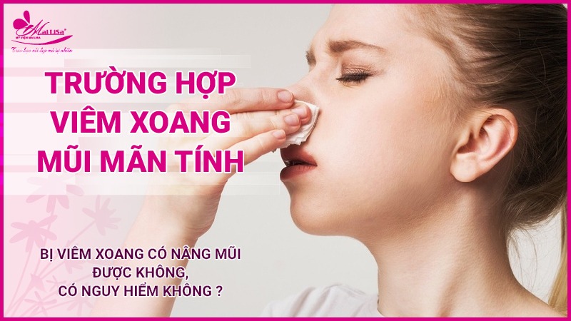 Bị viêm xoang có nâng mũi được không, có nguy hiểm không ? viêm xoang mũi mãn tính