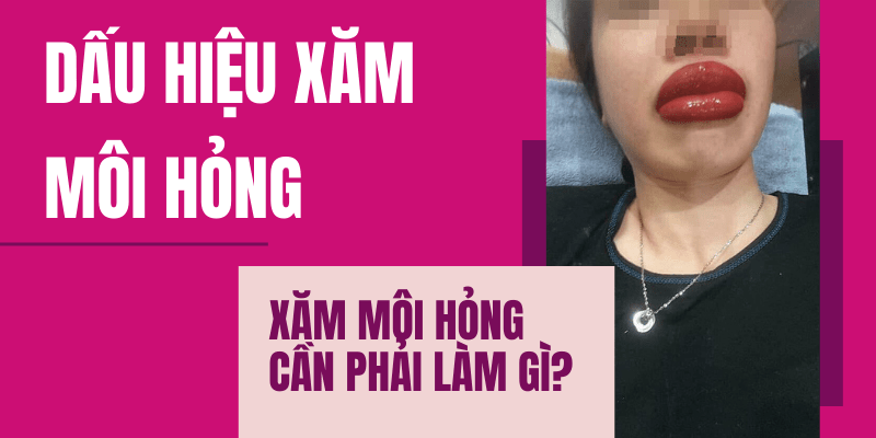 Phun môi bị hỏng, thất bại và nhiễm trùng thì phải làm sao? Cách khắc phục xăm môi hỏng phải làm sao