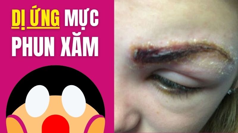 Phun xăm lông mày, môi có ảnh hưởng gì không? Có hại không? Có nguy hiểm không? Dị ứng mực xăm chân mày