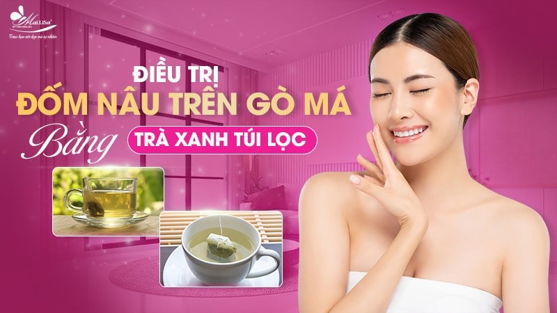 8 Cách trị đốm nâu trên mặt thịnh hành hiện nay 14 - 14 đốm nâu trên mặt dom nau tren mat