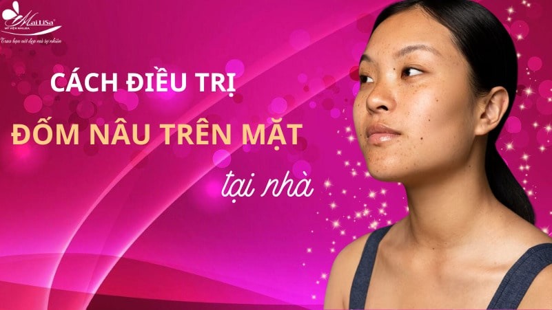 8 Cách trị đốm nâu trên mặt thịnh hành hiện nay 6 - 6 đốm nâu trên mặt dom nau