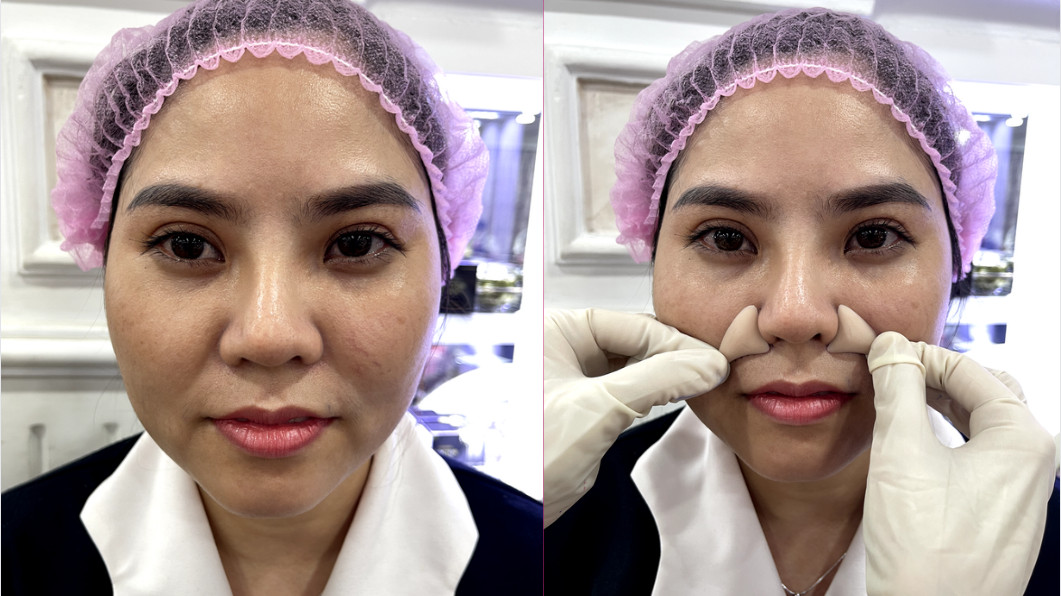 Làm đầy rãnh cười Babies line Làm đầy rãnh cười Babies line