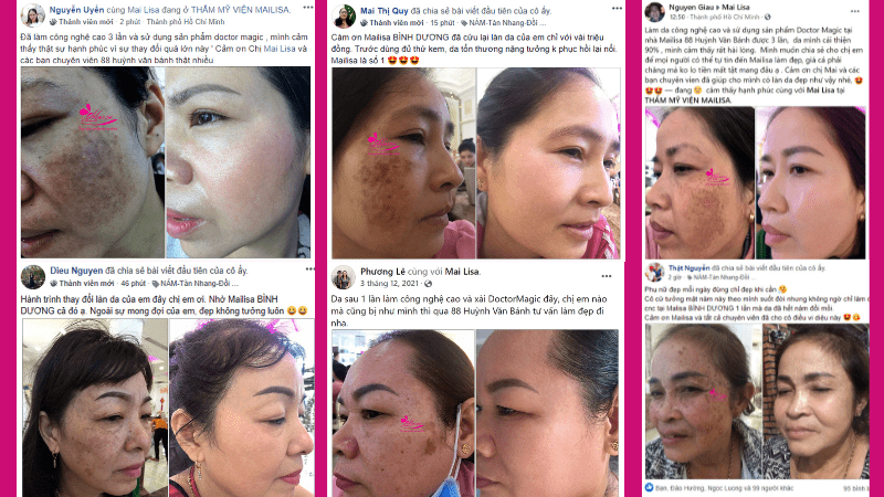 Bảng giá dịch vụ trị thâm mụn ở spa giá bao nhiêu 2022? feed-back-lieu-trinh-tri-tham-mun-nam-tan-nhang-tai-mailisa