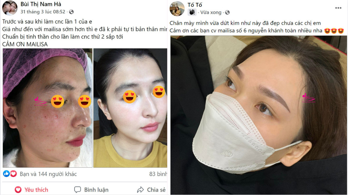 Thẩm mỹ viện Mailisa có thật sự đang lừa dối khách hàng? mailisa bị đình chỉ hoạt động