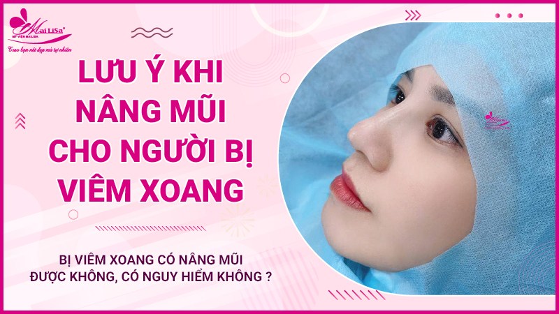 Bị viêm xoang có nâng mũi được không, có nguy hiểm không ? lưu ý khi viêm xoang đi nâng mũi