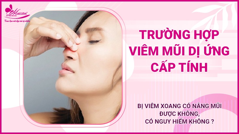 Bị viêm xoang có nâng mũi được không, có nguy hiểm không ? viêm mũi bị dị ứng có nâng mũi được không