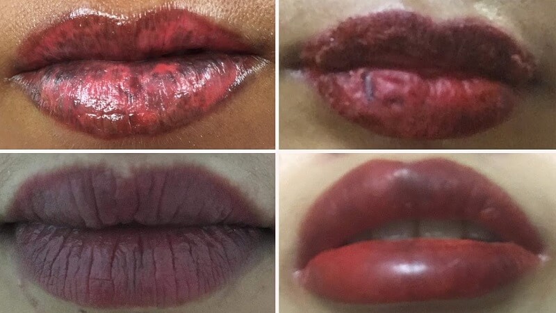 Phun môi bị khô bong tróc phải làm sao hết 2021 hình ảnh môi chảy máu