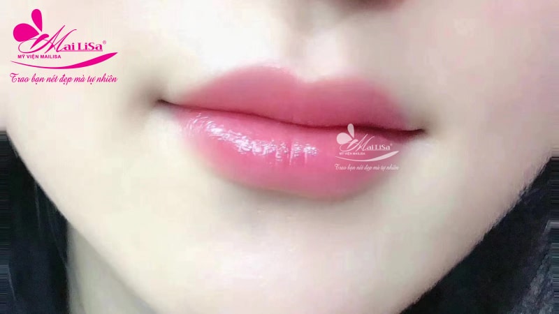 Phun xăm môi bị thâm phải làm sao? Cách khắc phục HIỆU QUẢ 2021 phun môi mailisa