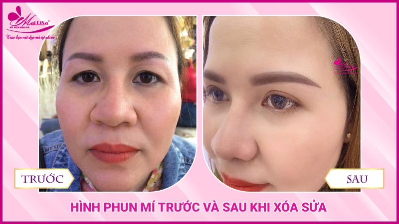 Phun mí mắt có đau không? Những lưu ý cần biết khi phun mí mắt phun xăm mí mắt