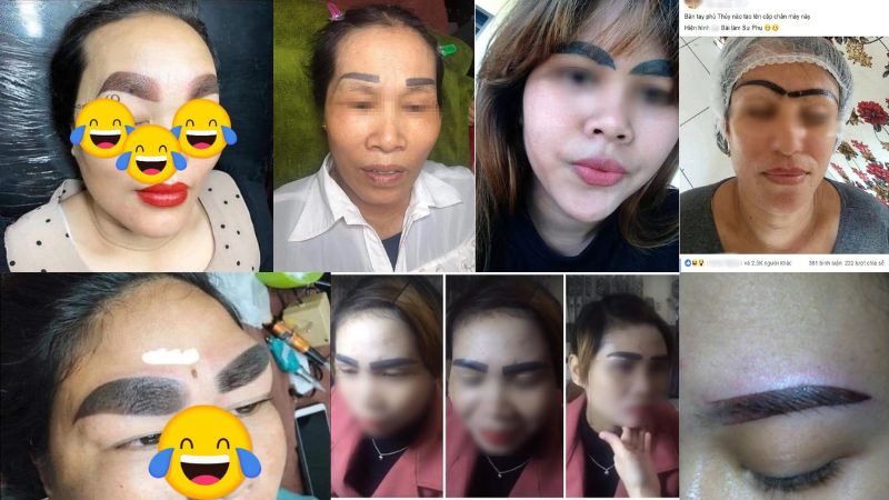 Tác hại của xăm chân mày NGHIÊM TRỌNG tại các TMV không uy tín Hình ảnh xăm lông mày bị sẹo