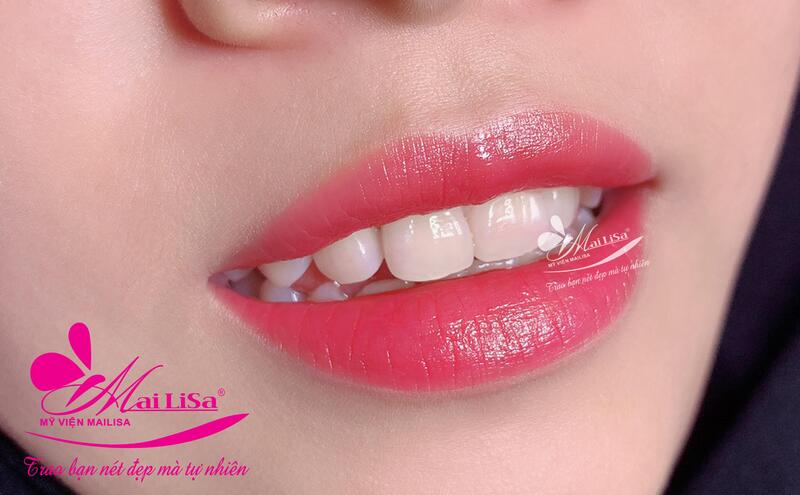 Phun môi hiệu ứng son lì 3D Mailisa: Có nên phun môi không? Phun môi ở mailisa giá bao nhiêu? phun môi hiệu ứng son lì 3d độc quyền mailisa