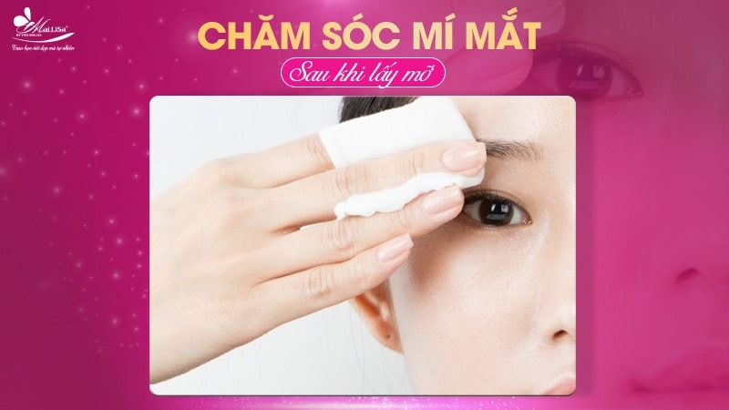 Lấy mỡ mí mắt trên bao nhiêu tiền? Dịch vụ ở đâu tốt 12 - 12 lấy mỡ mí mắt trên bao nhiêu tiền hut mo mat