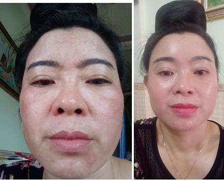 KEM DƯỠNG ẨM SÂU BÊN TRONG KEM DƯỠNG ẨM SÂU BÊN TRONG