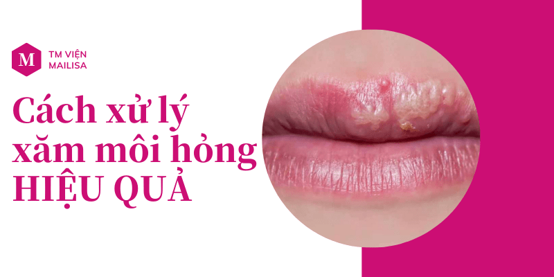 Phun môi bị hỏng, thất bại và nhiễm trùng thì phải làm sao? Cách khắc phục xử lý xăm môi hỏng