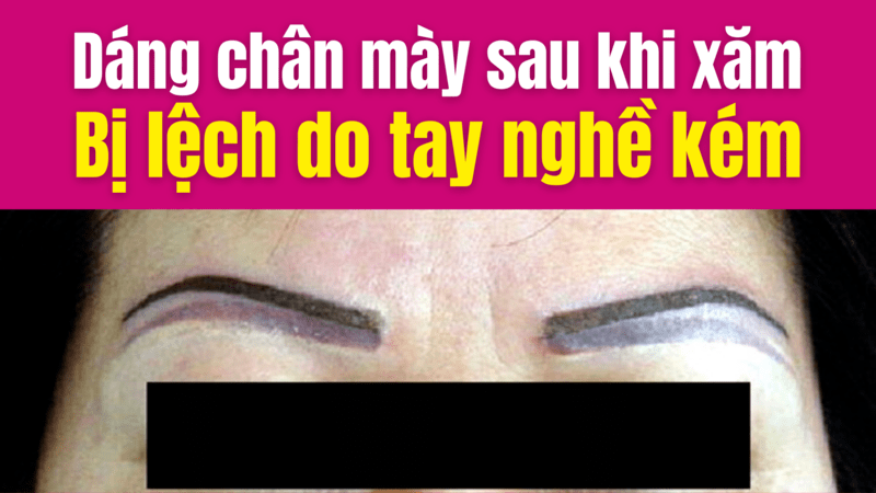 Phun xăm lông mày, môi có ảnh hưởng gì không? Có hại không? Có nguy hiểm không? Mẫu kiểu dáng xăm chân mày bị lệch