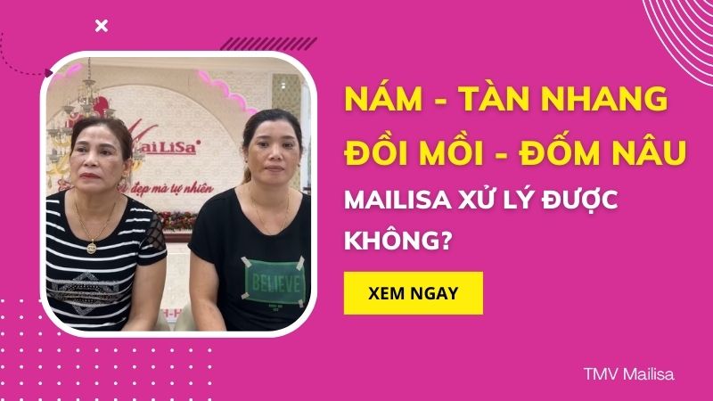 Thẩm mỹ viện Mailisa có lừa đảo khách hàng? THỰC HƯ CÁC TIN ĐỒN trong ngành THẨM MỸ thực hư tin đồn mailisa làm đẹp có uy tín không