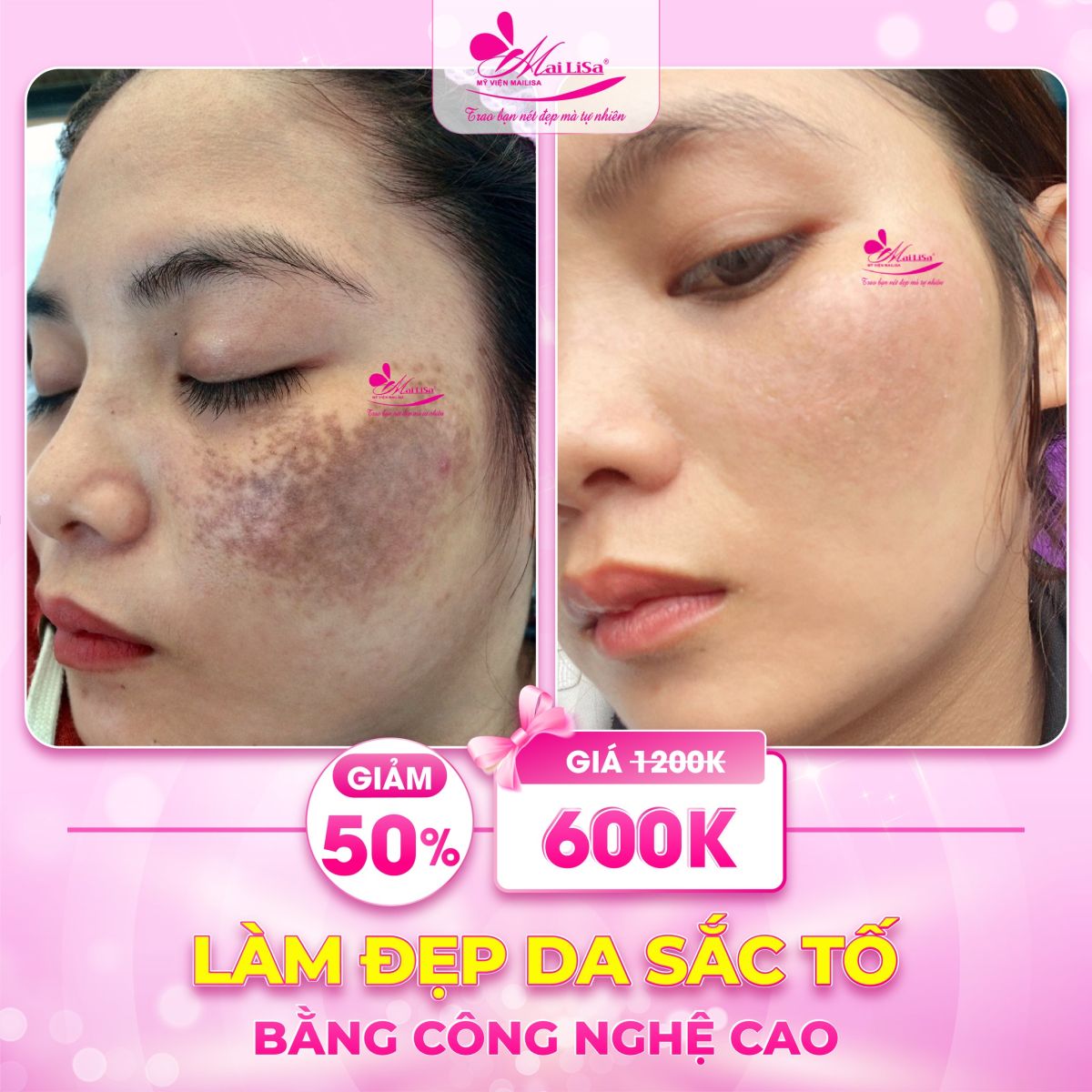 Phốt Mailisa Sự Thật Đằng Sau Phốt Mailisa Sự Thật Đằng Sau