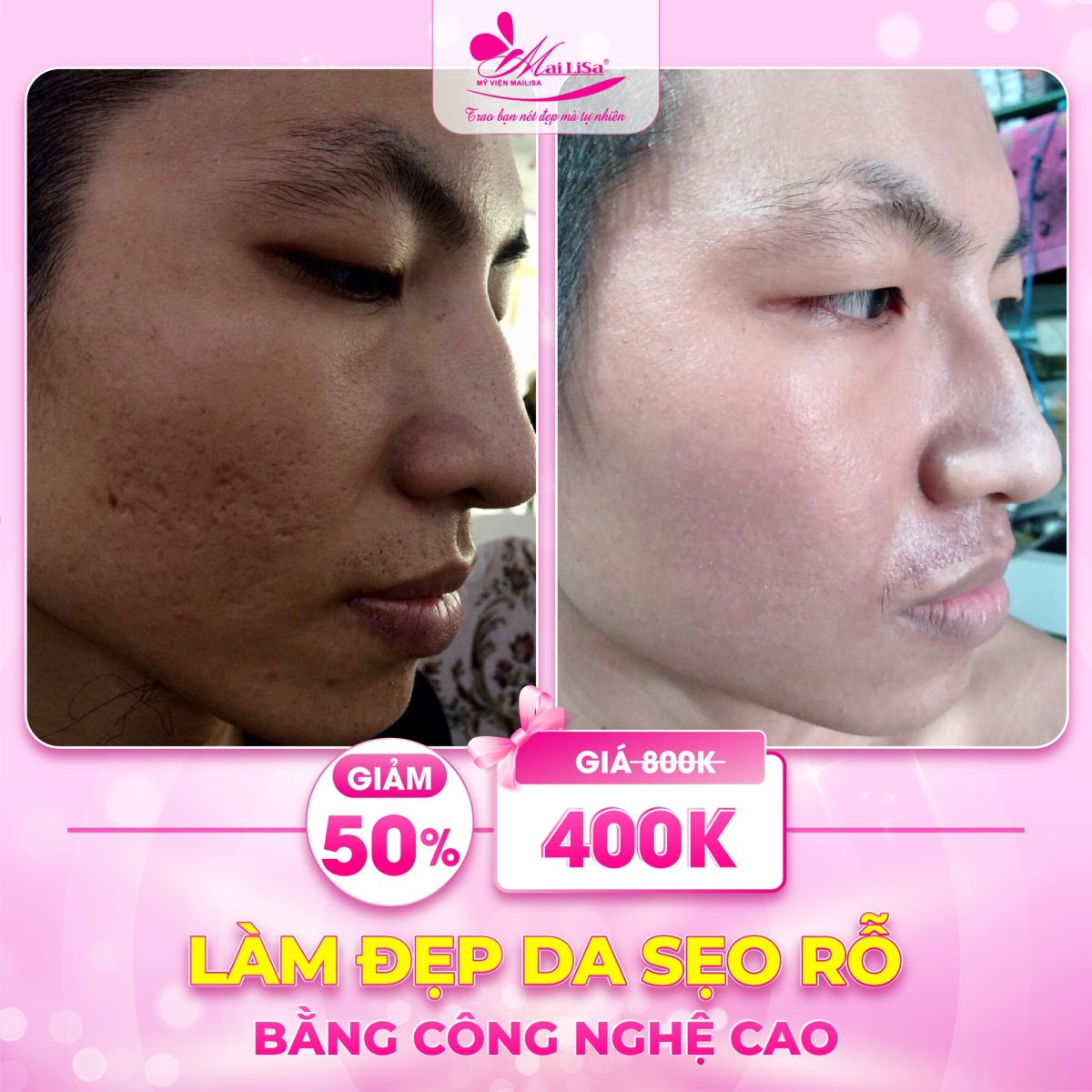 Phốt Mailisa Sự Thật Đằng Sau Phốt Mailisa Sự Thật Đằng Sau