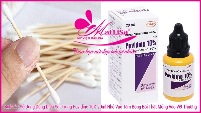 Bị viêm xoang có nâng mũi được không, có nguy hiểm không ? sát trùng vết khâu