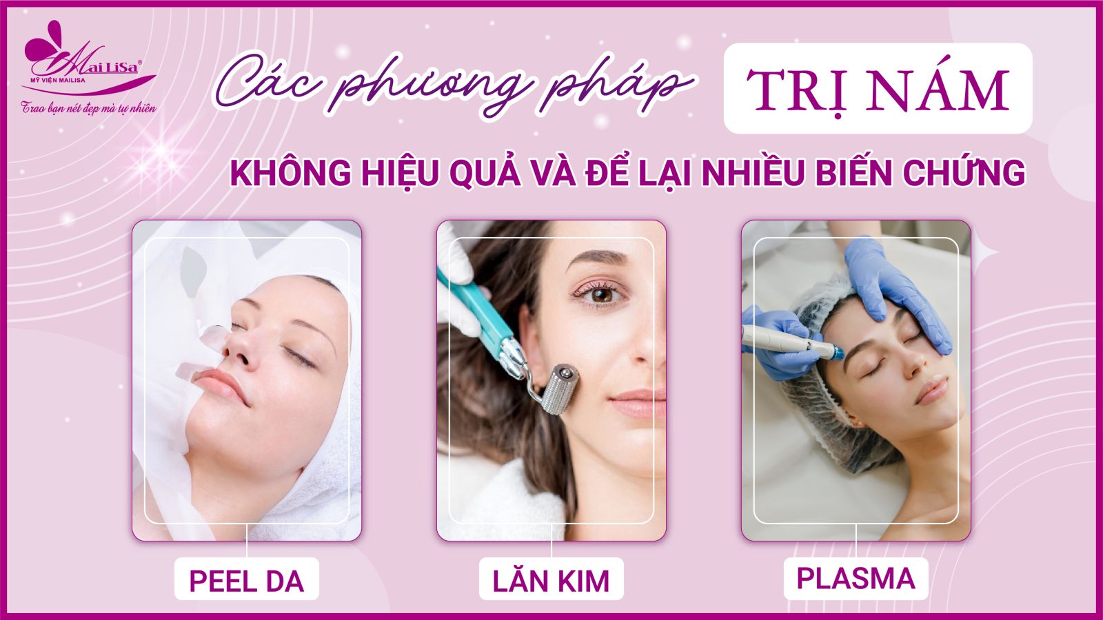 Bắn laser trị nám Whiteskin spectra có tốt không? Chi phí 2023 Bắn laser trị nám Whiteskin spectra có tốt không? Chi phí 2023