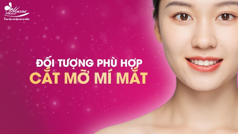 Lấy mỡ mí mắt trên bao nhiêu tiền? Dịch vụ ở đâu tốt 7 - 7 lấy mỡ mí mắt trên bao nhiêu tiền lay mo mi mat