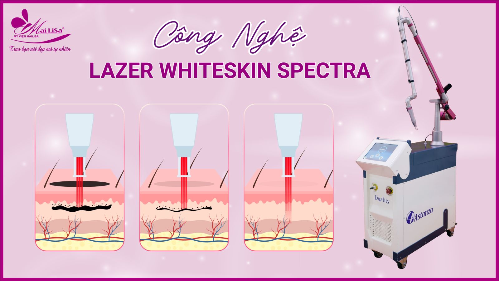 Bắn laser trị nám Whiteskin spectra có tốt không? Chi phí 2023 Bắn laser trị nám Whiteskin spectra có tốt không? Chi phí 2023