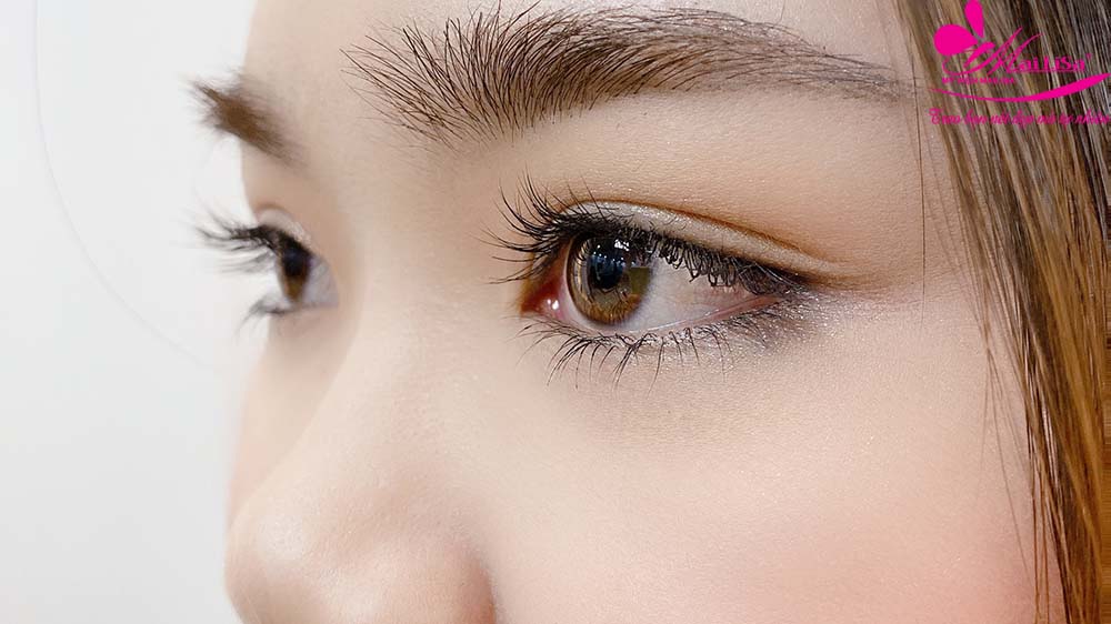 Phân biệt giữa nhấn mí và cắt mí mắt tại Mailisa Phân biệt giữa nhấn mí và cắt mí mắt tại Mailisa