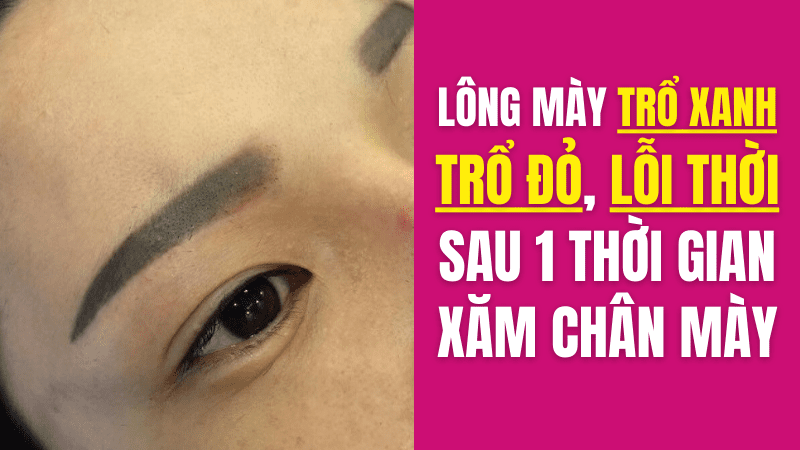 Phun xăm lông mày, môi có ảnh hưởng gì không? Có hại không? Có nguy hiểm không? Chân mày lỗi thời sau khi xăm lông mày