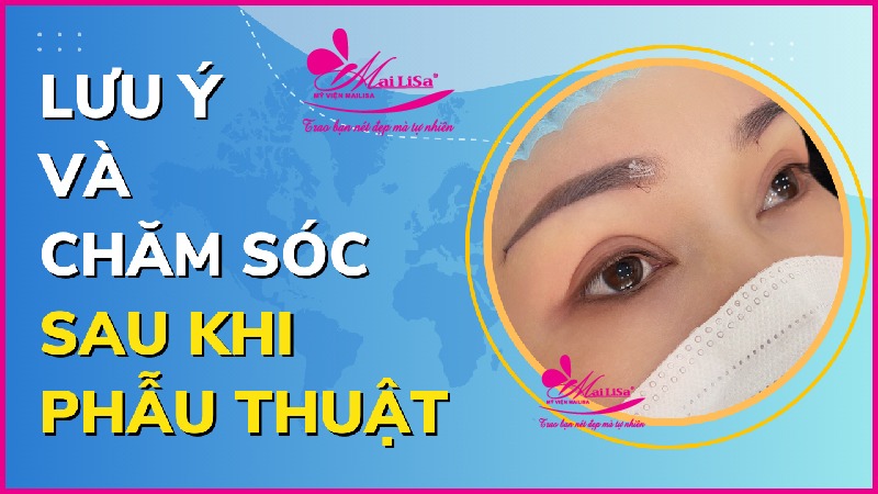 Phẫu thuật nâng cơ mí mắt là gì? Giá bao nhiêu HỢP LÝ 2023? Lưu ý chăm sóc sau phẫu thuật