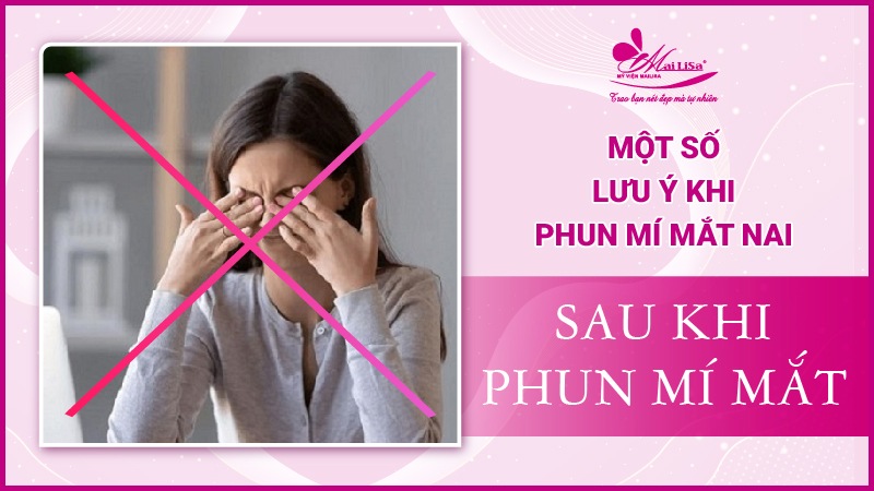 Mắt nai là gì? Tướng số người mắt nai sẽ như thế nào Lưu ý sau khi nâng mí