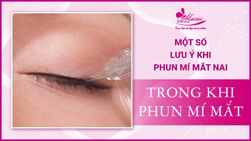 Mắt nai là gì? Tướng số người mắt nai sẽ như thế nào Lưu ý trong khi phu mí mắt nai