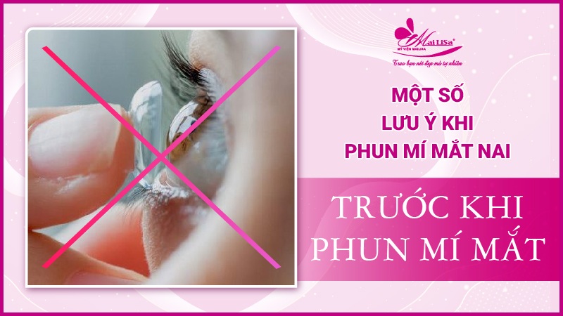 Mắt nai là gì? Tướng số người mắt nai sẽ như thế nào Lưu ý trước khi phun mí mắt nai