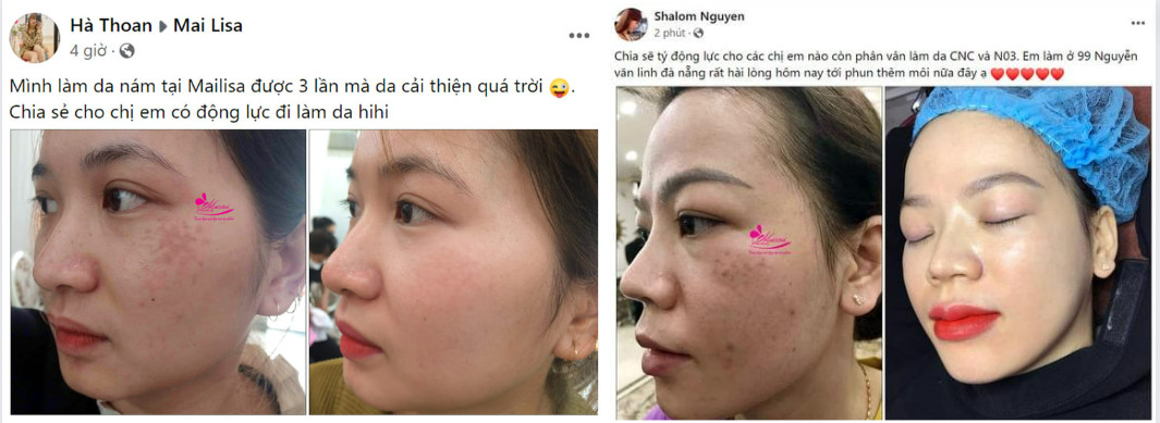 Thẩm mỹ viện Mailisa có thật sự đang lừa dối khách hàng? thẩm mỹ viện mailisa bị kiểm tra