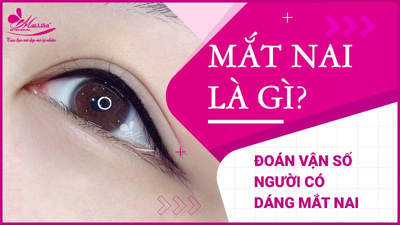 Mắt nai là gì? Tướng số người mắt nai sẽ như thế nào Mắt nai là gì người có dáng mắt nai