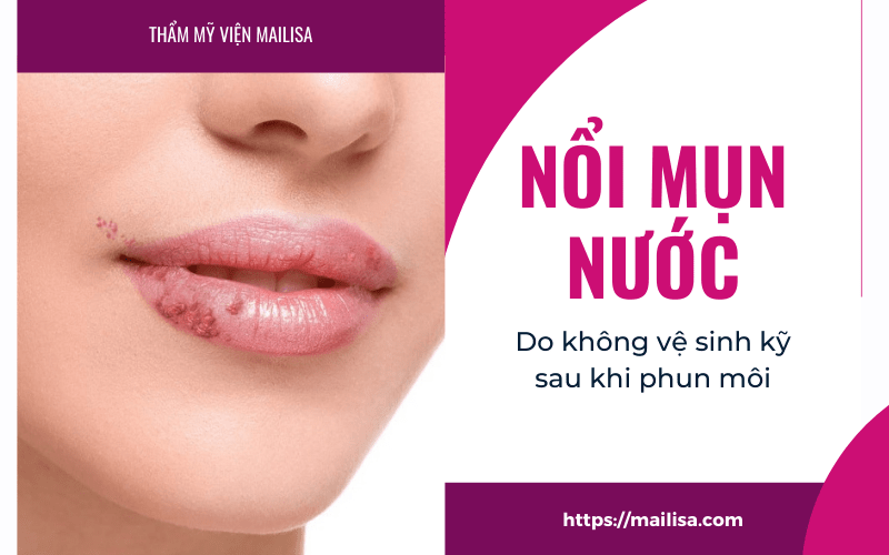 Mụn nước ở môi sau khi phun xăm có nguy hiểm không? Nên uống thuốc gì? nổi mụn nước do không vệ sinh kỹ sau phun môi