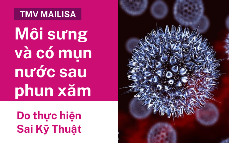 Mụn nước ở môi sau khi phun xăm có nguy hiểm không? Nên uống thuốc gì? mọc mụn nước ở môi do thục hiện sai kỹ thuật